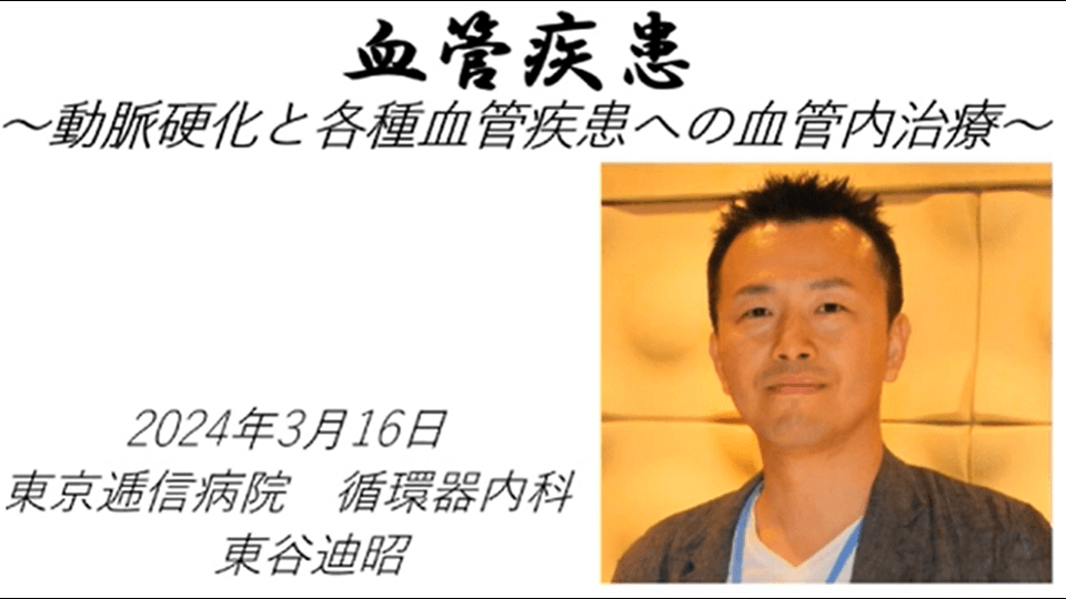血管疾患 ～動脈硬化と各種血管疾患への血管内治療～の動画を別ウィンドウで開く