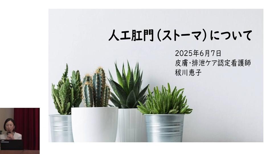 人工肛門（ストーマ）についての動画を別ウィンドウで開く